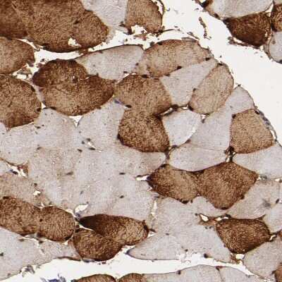 Immunohistochemistry-Paraffin: GLCCl1 Antibody [NBP1-87939]