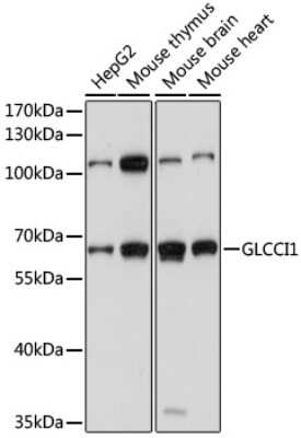 Western Blot: GLCCl1 AntibodyAzide and BSA Free [NBP3-03345]