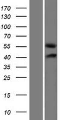 Western Blot: GLCCl1 Overexpression Lysate [NBP2-05671]