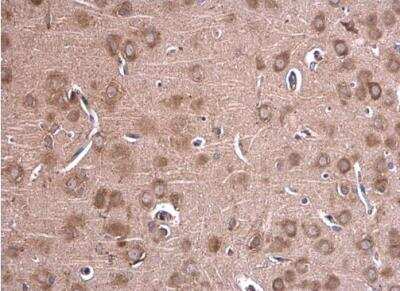 Immunohistochemistry-Paraffin: GLDC Antibody [NBP1-32907]