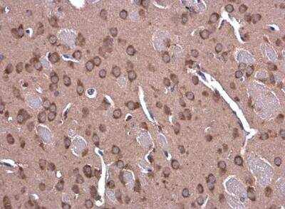 Immunohistochemistry-Paraffin: GLDC Antibody [NBP1-32907]