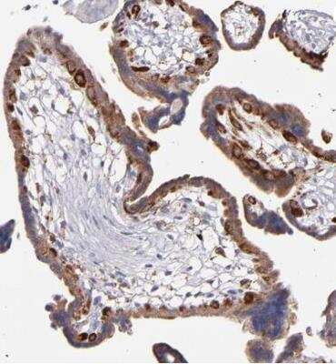 Immunohistochemistry-Paraffin: GLDC Antibody [NBP1-83374]