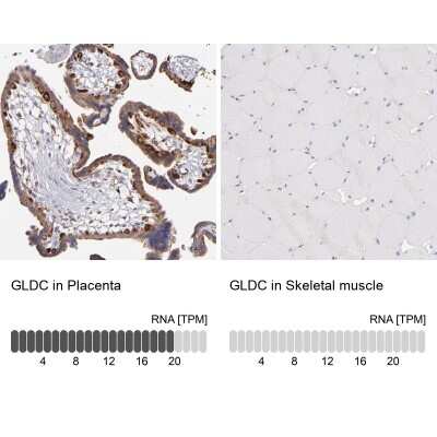 Immunohistochemistry-Paraffin: GLDC Antibody [NBP1-83374]