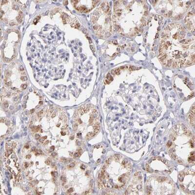 Immunohistochemistry-Paraffin: GLDC Antibody [NBP1-83374]