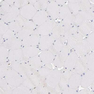 Immunohistochemistry-Paraffin: GLDC Antibody [NBP1-83374]