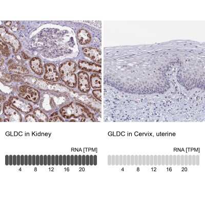 Immunohistochemistry-Paraffin: GLDC Antibody [NBP2-38682]