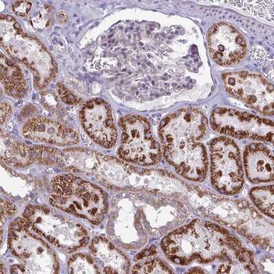 Immunohistochemistry-Paraffin: GLDC Antibody [NBP2-38682]