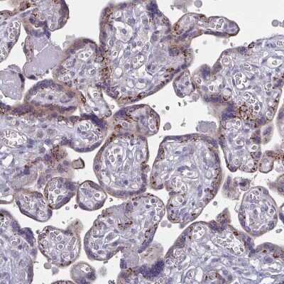 Immunohistochemistry-Paraffin: GLDC Antibody [NBP2-38682]