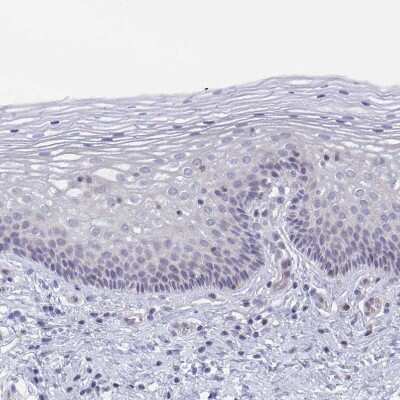 Immunohistochemistry-Paraffin: GLDC Antibody [NBP2-38682]