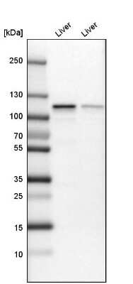 Western Blot: GLDC Antibody [NBP1-83374]