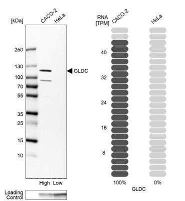Western Blot: GLDC Antibody [NBP1-83374]