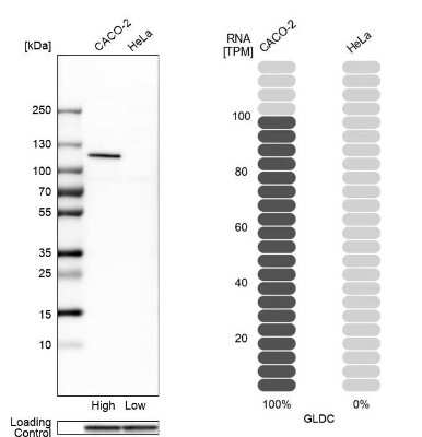 Western Blot: GLDC Antibody [NBP2-38682]