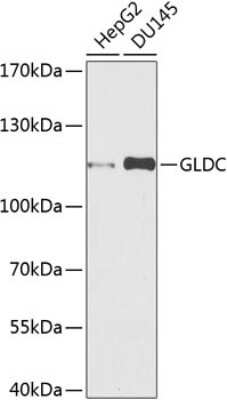 Western Blot: GLDC AntibodyBSA Free [NBP3-04989]