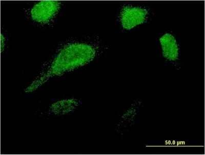 Immunocytochemistry/ Immunofluorescence: GLE1 Antibody (1D8) [H00002733-M03]