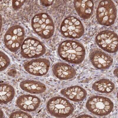 Immunohistochemistry-Paraffin: GLE1 Antibody [NBP2-47449]