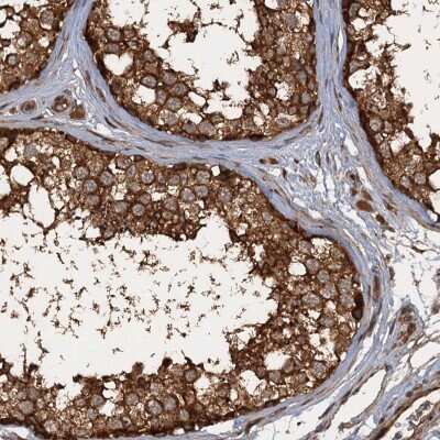 Immunohistochemistry-Paraffin: GLE1 Antibody [NBP2-47450]