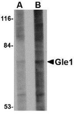 Western Blot: GLE1 AntibodyBSA Free [NBP1-76979]