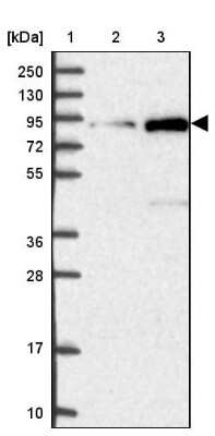 Western Blot: GLE1 Antibody [NBP2-47449]