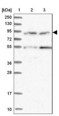 Western Blot: GLE1 Antibody [NBP2-47450]