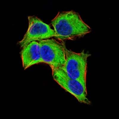 Immunocytochemistry/ Immunofluorescence: GLI-1 Antibody (1B9F8) - BSA Free [NBP2-52475]