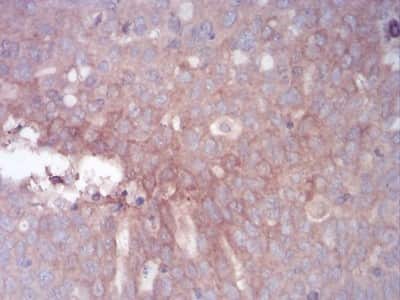 Immunohistochemistry-Paraffin: GLI-1 Antibody (1B9F8) - BSA Free [NBP2-52475]