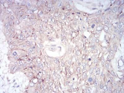 Immunohistochemistry-Paraffin: GLI-1 Antibody (1B9F8) - BSA Free [NBP2-52475]
