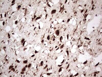 Immunohistochemistry: GLI-1 Antibody (OTI4E2) [NBP2-45872]