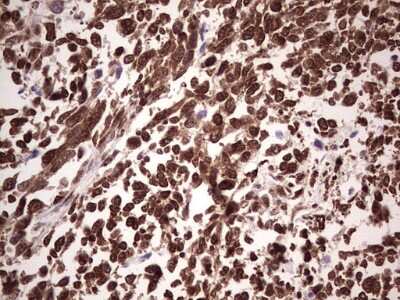 Immunohistochemistry: GLI-1 Antibody (OTI4E2) [NBP2-45872]