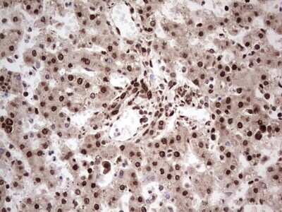 Immunohistochemistry: GLI-1 Antibody (OTI4E2) [NBP2-45872]