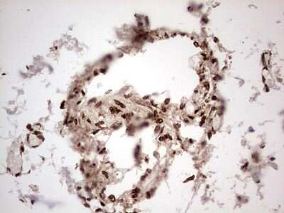 Immunohistochemistry: GLI-1 Antibody (OTI4E2) [NBP2-45872]