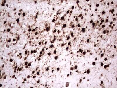 Immunohistochemistry: GLI-1 Antibody (OTI4E2) [NBP2-45872]