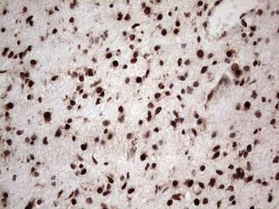 Immunohistochemistry: GLI-1 Antibody (OTI4E2) [NBP2-45872]