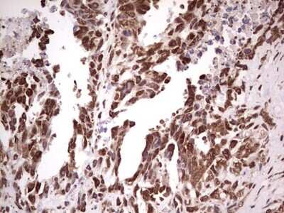 Immunohistochemistry: GLI-1 Antibody (OTI4E2) [NBP2-45872]