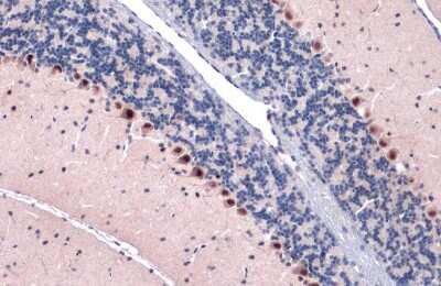 Immunohistochemistry-Paraffin: GLI-1 Antibody (GT249) [NBP3-13674]