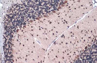 Immunohistochemistry-Paraffin: GLI-1 Antibody (HL247) [NBP3-13667]