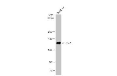 Western Blot: GLI-1 Antibody (HL247) [NBP3-13667]