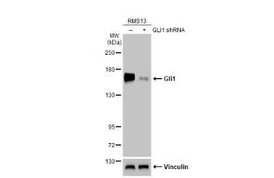 Western Blot: GLI-1 Antibody (HL247) [NBP3-13667]