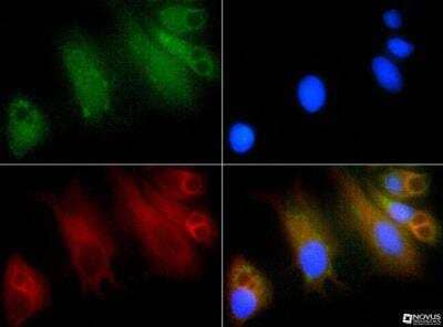 Immunocytochemistry/ Immunofluorescence: GLI-1 Antibody - BSA Free [NBP1-78259]