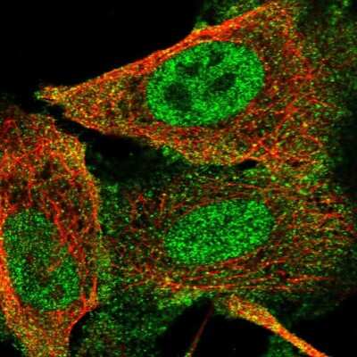 Immunocytochemistry/ Immunofluorescence: GLI-1 Antibody [NBP2-56230]