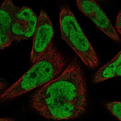 Immunocytochemistry/ Immunofluorescence: GLI-1 Antibody [NBP2-68877]