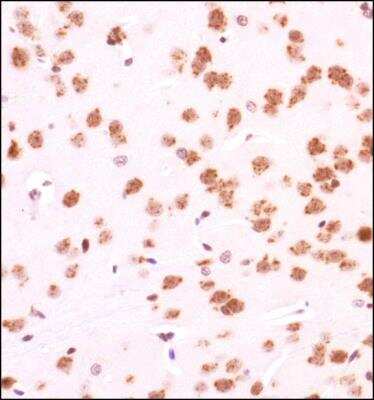 Immunohistochemistry: GLI-1 Antibody - BSA Free [NBP1-78259]