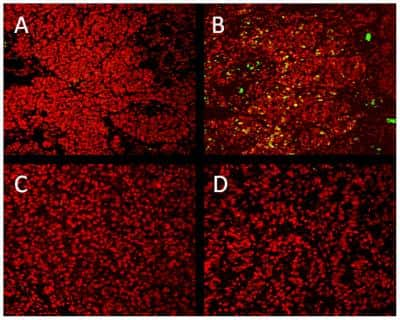 Immunohistochemistry: GLI-1 Antibody - BSA Free [NBP1-78259]