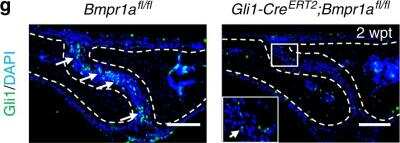 Immunohistochemistry: GLI-1 Antibody - BSA Free [NBP1-78259]