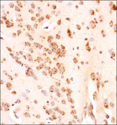 Immunohistochemistry-Paraffin: GLI-1 Antibody - BSA Free [NB600-600]