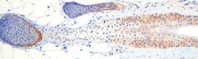 Immunohistochemistry-Paraffin: GLI-1 Antibody - BSA Free [NB600-600]