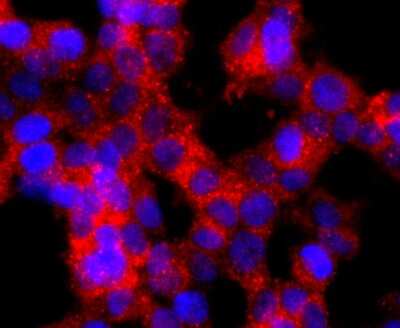 Immunocytochemistry/ Immunofluorescence: GLI-1 Antibody (JF09-08) [NBP2-66867]