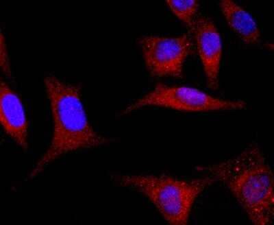 Immunocytochemistry/ Immunofluorescence: GLI-1 Antibody (JF09-08) [NBP2-66867]