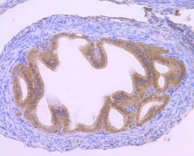 Immunohistochemistry-Paraffin: GLI-1 Antibody (JF09-08) [NBP2-66867]