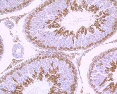 Immunohistochemistry-Paraffin: GLI-1 Antibody (JF09-08) [NBP2-66867]