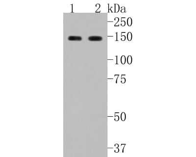 Western Blot: GLI-1 Antibody (JF09-08) [NBP2-66867]